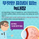 녹내장 초기증상 및 원인과 방법 주의사항 이미지