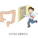 대장증후군 이미지