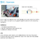 공콘택트렌즈 이미지