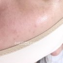 선메디텍 이미지