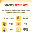 에스케어 이미지