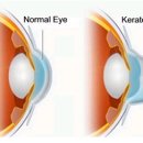 밝은눈안경원 이미지