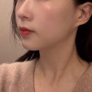 방배1동주민센터 소회의실 | 방배동 피부과 온다리프팅 가격, 내돈내산 후기