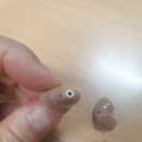 종로 보청기 이미지