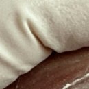 레푸스 삼성점 강남네일인디고 내성발톱 발톱무좀 발굳은살