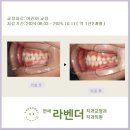 연세어린이치과의원 | 연세 라벤더 교정치과 "11월 어린이 교정" 후기