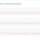 9월달에 4차 시술 예약 했습니다. 이미지