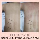 대구 테라노바, 이제는 숨기지 말고 자신 있게 드러내세요!