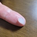 라이온 덴트헬스 R 연고 내돈내산 후기: 잇몸 붓기·통증 완화 효과는?