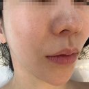 상도동 [신대방삼거리피부관리] 스킨유랩, 내돈내산 방문후기