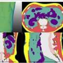 아이피메디칼 이미지