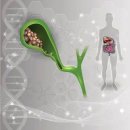 한 해 신규환자 7500명.. 쓸개 암, ‘이것’ 조심해야 이미지