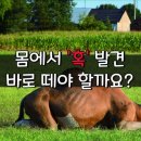 #몸에 혹 암덩어리 이미지