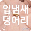 조준만이비인후과의원 | 입냄새 덩어리 알갱이 편도결석 원인 제거 빼는 방법