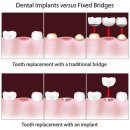 휴플란트치과의원 이미지
