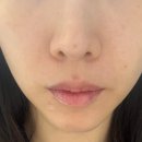 건대 피부 관리, 어디서 받아야 할까? 트리버에스테틱 성수 스킨널싱 후기 (뚝섬, 성동구 추천)