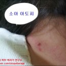임브레이스 이미지