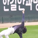 14살에 오른 대퇴골두골단분리증 수술 / 15살에 왼 대퇴골두골단분리증 수술 / 16살에 양쪽 나사못 제거 수술 이미지