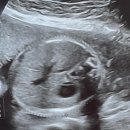 강남-154 | 임당검사(OGTT) 결과 수치 154? 공포의 재검 당첨 후기 (feat. 강남차병원, 임신 23주차, 재검날짜, GCT)