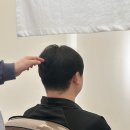 동탄탈모두피본연 이미지