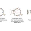 우리눈안경 이미지