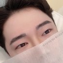 애드브로우
