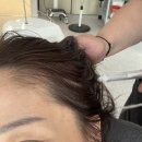 디알메디칼 | [부산] 서면두피관리 ‘모바이오 다시봄날 부산서면’ 탈모관리 후기