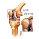 무릎 구부릴 때 통증, 슬개골 연골연화증 (무릎테이핑방법) 이미지