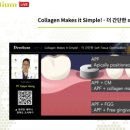 (주)덴티움 | 콜라겐 재료를 이용한 잇몸 이식 - 오래가는 임플란트를 위한 치료 (덴티움 아카데미 강의 후기)