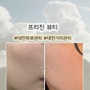 대전 잡티관리 프리진 뷰티 피부 관리 후기