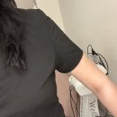 청담슬림의원 | 팔 브라라인 지방흡입 3개월 솔직 후기 | 논현동 지방흡입 가격 효과 통증 붓기