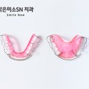 밝은이치과기공소 이미지