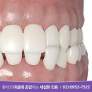 서울오라클치과의원 이미지