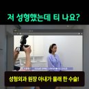 논현맑은의원 | 눈 성형 후 사나워진 얼굴, 딱 1가지가 똑같습니다