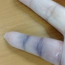 여의도통사의원 네이버블로그