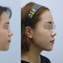 마마붐붐 이미지
