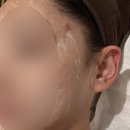 수영 에스테틱 스킨더시그니처 여드름 케어 후기