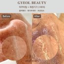 &#34;수원 인계동 아쿠아필 잘하는 곳 찾았어요!! 피부결 미쳤다&#34;