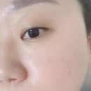 오리온피부관리실 | [강남 레이저토닝] 색소침착으로 스트레스이신 분들 주목이요!