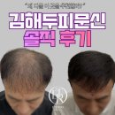 김해두피문신 후기, 사람들이 중요하게 보는 건 따로 있습니다