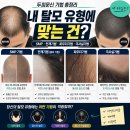 두피문신 기법 총정리 | SMP·안개기법·파우더기법·극사실기법 — 내 탈모 유형에 맞는 건?