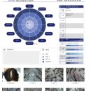 분당삼평-D-2 | [분당 야탑 두피 케어 ] 여성 탈모 초기라면, 웰킨 두피탈모센터 분당야탑점 추천 찐 후기!
