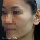 더(The)예쁜얼굴만들기성형외과의원 이미지