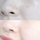 다이소 차앤박 CNP 바이오디티디 스팟 카밍 젤 사용해 본 후기!