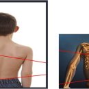 척추/골반/재활[척추 수술/시술 판정 및 재발하신 분 전문.. 목 & 허리 디스크, 척추 협착증 & 측만증 & 분리증, 좌골신경통..] & 보디빌딩 1:1 맞춤 운동 전문 이미지