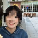 예뻐져따 | 30대 여자 치아교정 | 1년 후기 인비절라인 마지막 단계