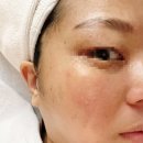 디어 문 뷰티 | 구미스킨플래닝 디어모먼트뷰티 예민피부도 안전한 프리미엄 스킨플래닝 후기!