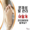 레푸스 다산