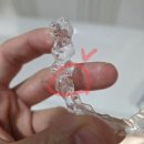 첼로교실(4개월 과정) | 인비절라인 교정 (3) 투명교정 4개월차 진짜 이야기｜파손된 장치, 반납, 어태치먼트 재부착, 충치 발견...