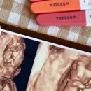 에덴산부인과의원 네이버블로그